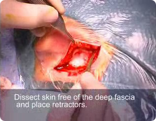 Make incision